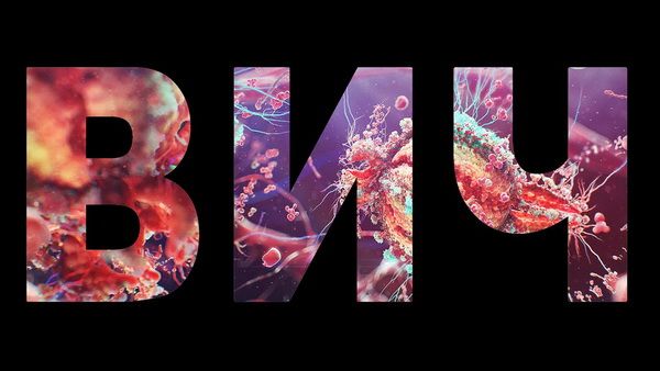ВИЧ – инфекция