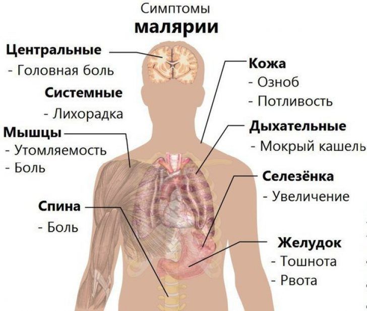 Малярия